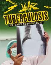 Tuberculosis: How the White Death Changed History
