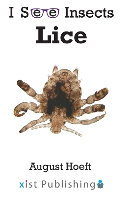 Lice