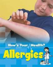Allergies