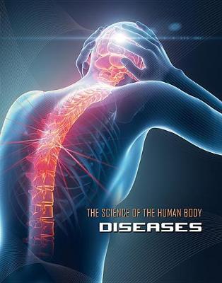 Science of the Human Body: Diseases