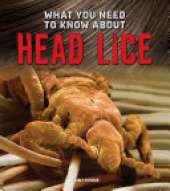 What You Need to Know about Head Lice