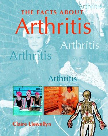 FACTS ABOUT ARTHRITIS