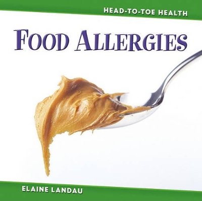 Food Allergies