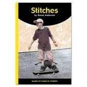 Stitches