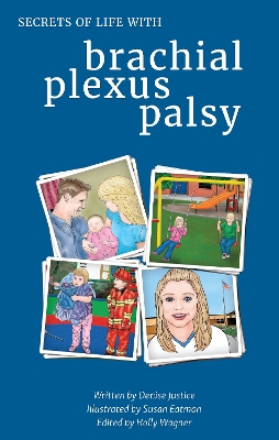 Secrets of Life with Brachial Plexus Palsy