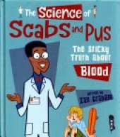The Science Of Scabs & Pus: The Slimy Truth About Blood
