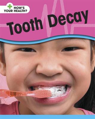 How's Your Health: Tooth Decay
