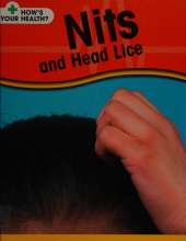 How's Your Health: Nits and Headlice