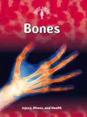 Bones