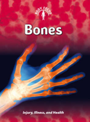 Bones