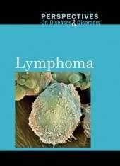 Lymphoma