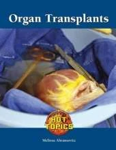 Organ Transplants