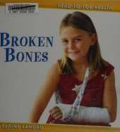 Broken Bones