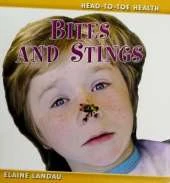 Bites and Stings