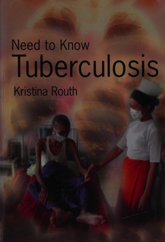Need To Know: Tuberculosis Paperback