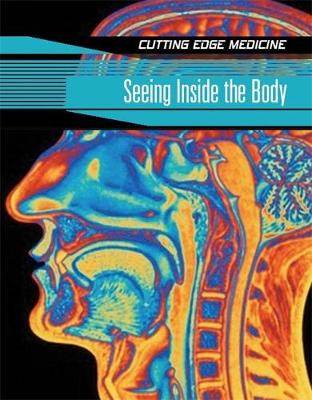 Cutting Edge Medicine: Seeing Inside The Body